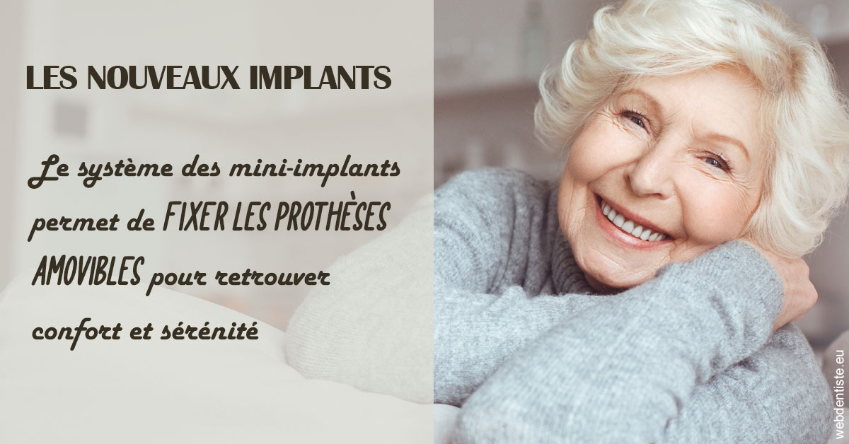 https://selarl-emile-roux.chirurgiens-dentistes.fr/Les nouveaux implants 1