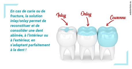 https://selarl-emile-roux.chirurgiens-dentistes.fr/L'INLAY ou l'ONLAY