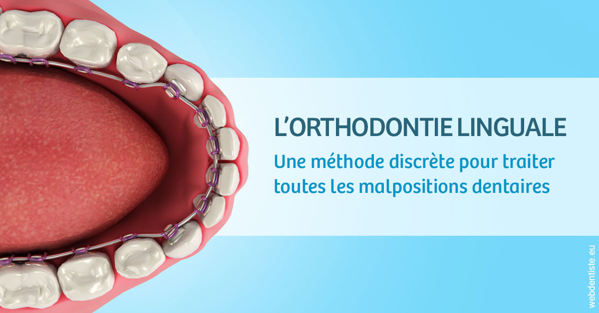 https://selarl-emile-roux.chirurgiens-dentistes.fr/L'orthodontie linguale 1