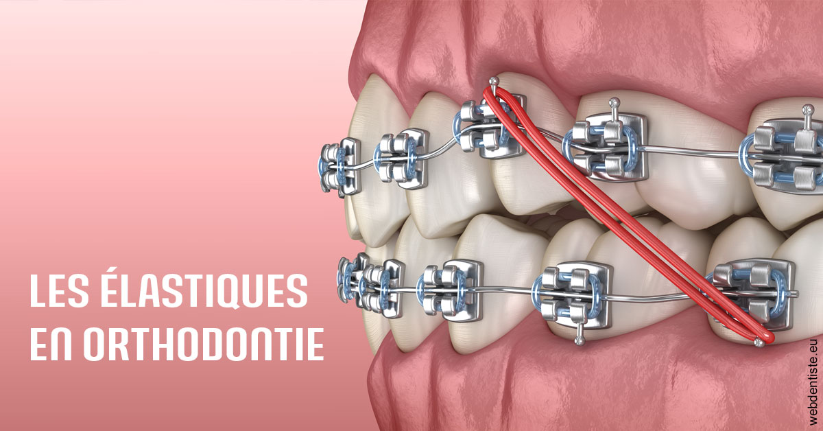 https://selarl-emile-roux.chirurgiens-dentistes.fr/Elastiques orthodontie 2