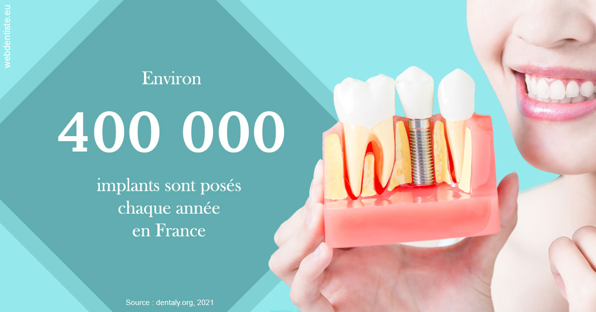 https://selarl-emile-roux.chirurgiens-dentistes.fr/Pose d'implants en France 2